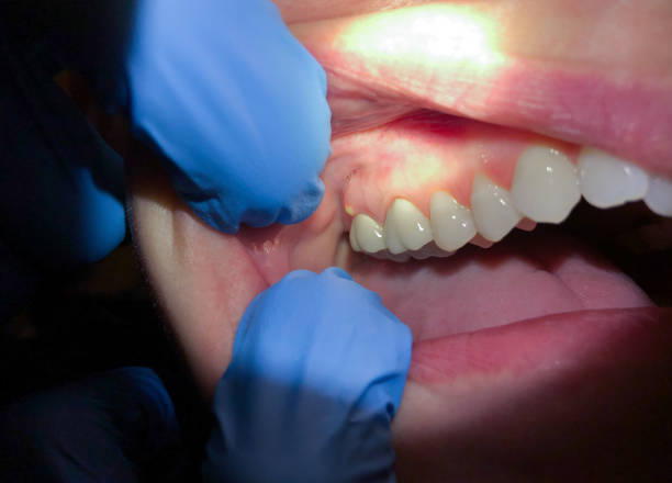 Best Urgent Tooth Repair  in Columbia City, OR