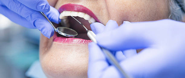 Best Chipped Tooth Repair Near Me  in Columbia City, OR
